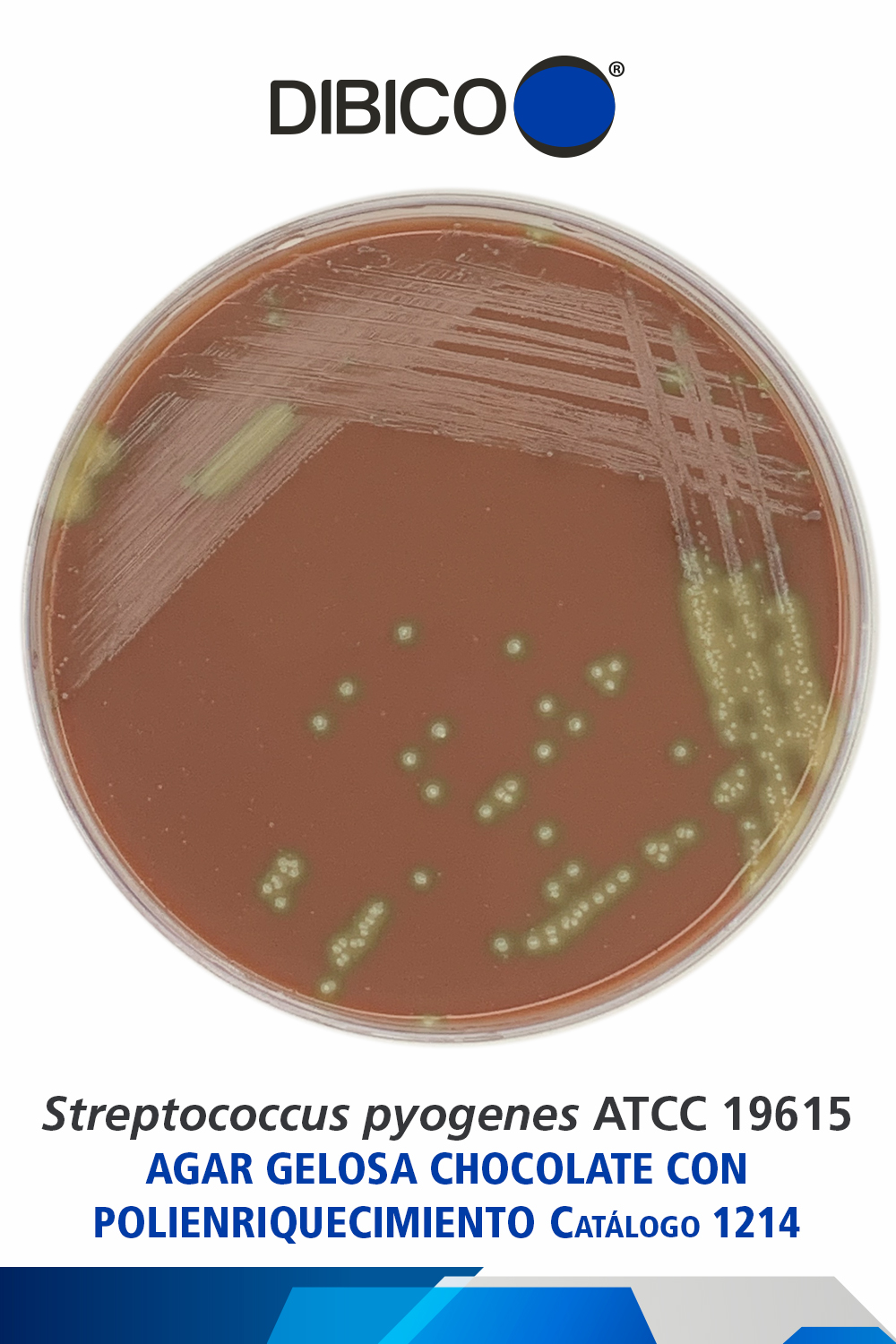 1214 Streptococcus pyogenes